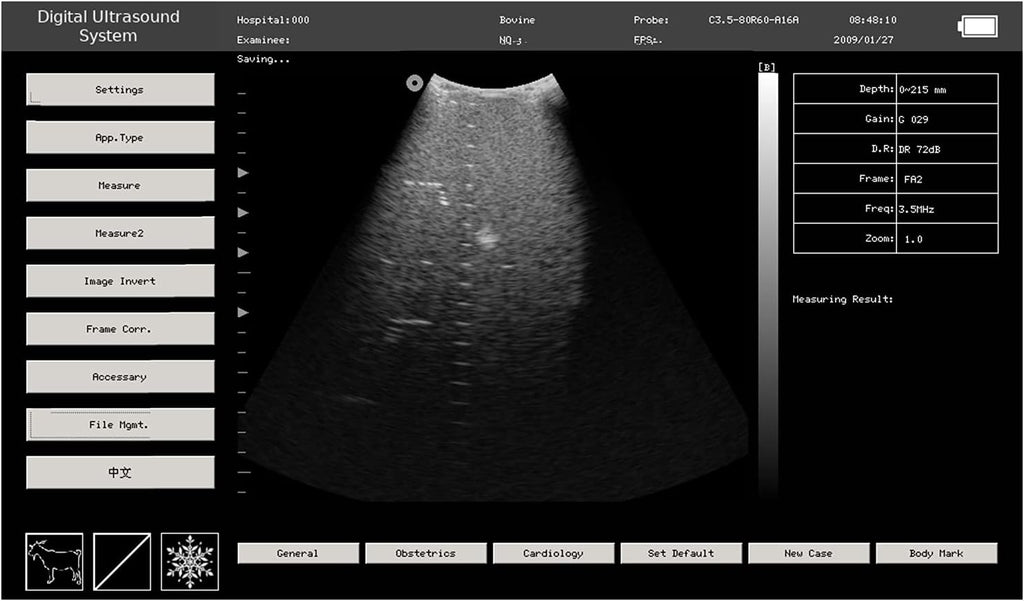 Veterinary Ultrasound Scanner with Convex and Rectal Linear Probe L361851